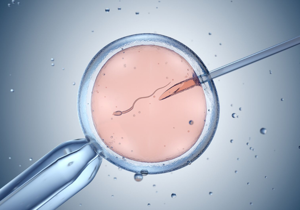  What is IVF?