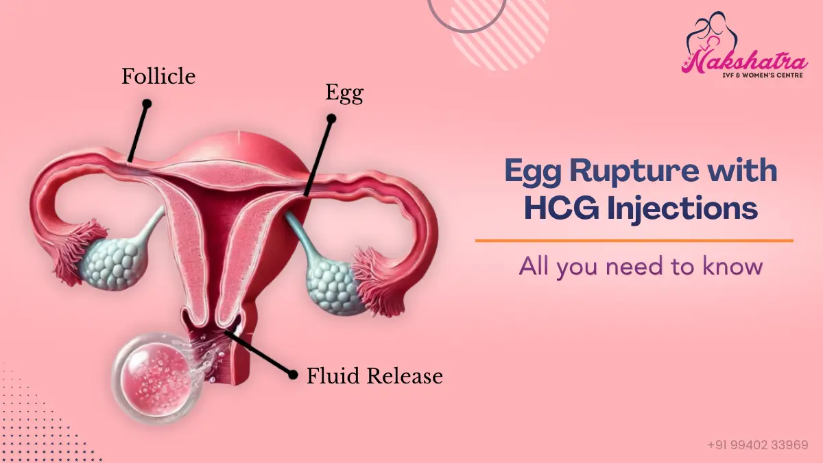Egg Rupture with hCG Injections: Symptoms, Timing, and Role in IVF 