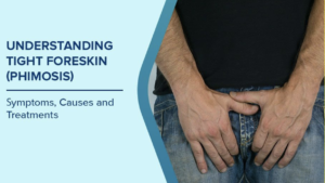 Phimosis in Adult Men: Does it Affect Fertility?