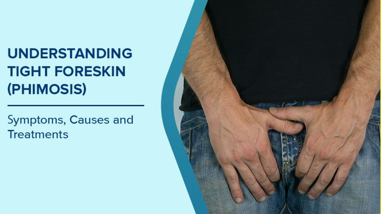 Phimosis in Adult Men: Does it Affect Fertility?