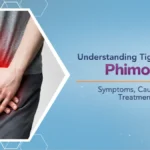phymosis-issues-guide